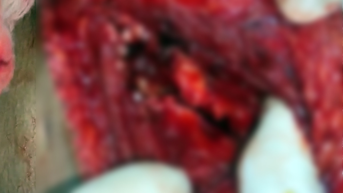 Prayagraj doctor saved life