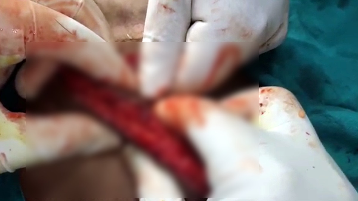 Prayagraj doctor saved life