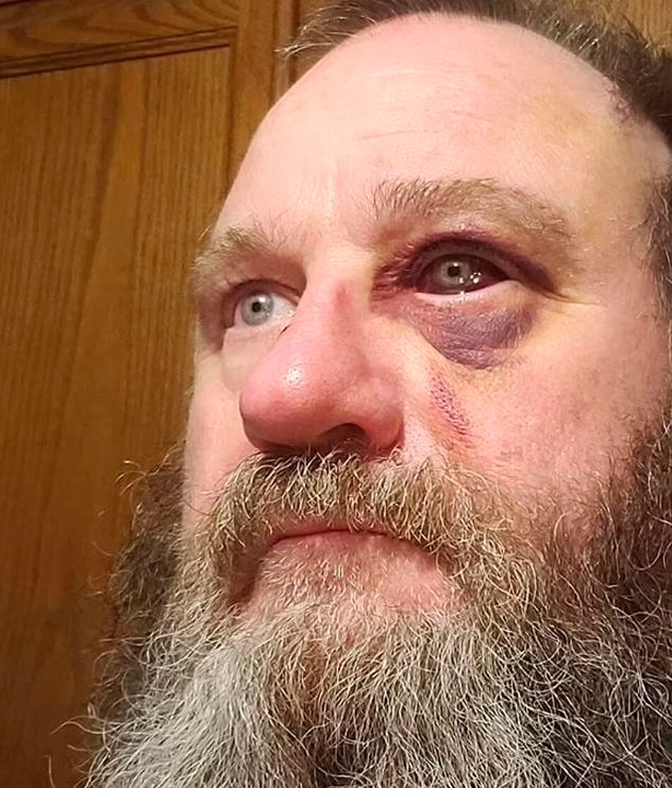 man got ten years for spitting