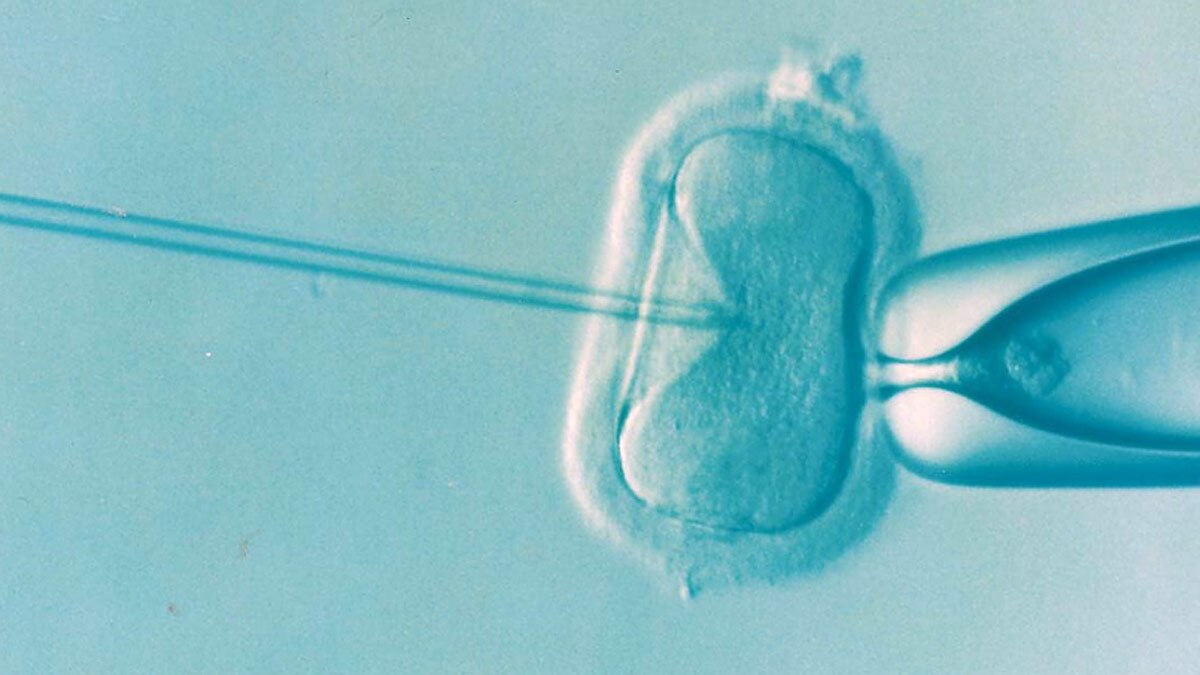 एग्स कीमती होते हैं