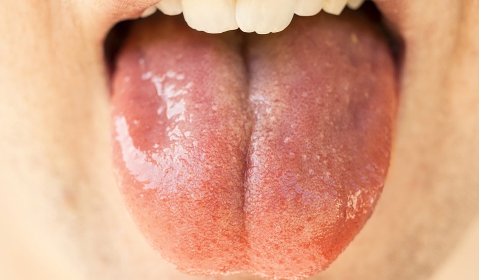  पैरागेसिया एक टेस्ट डिसऑर्डर6