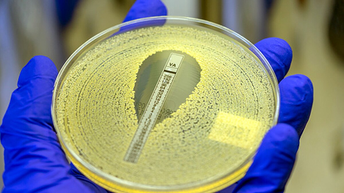 Antibiotic resistance Pandemic