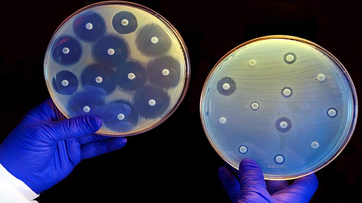 Antibiotic resistance Pandemic