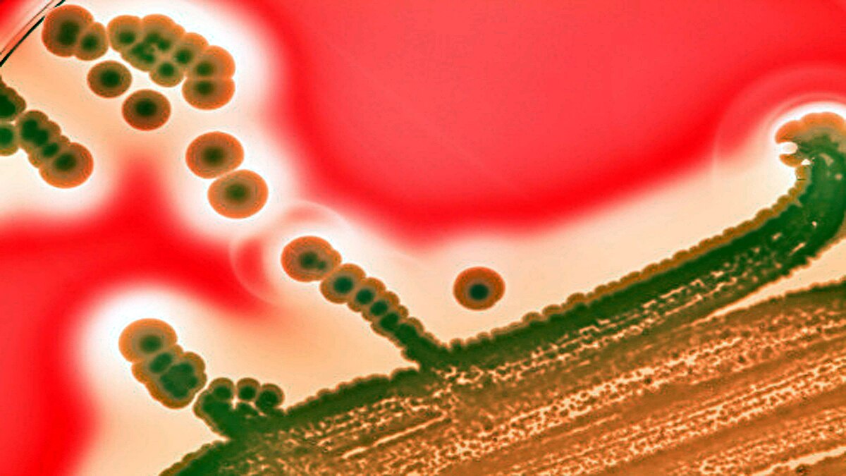 Antibiotic resistance Pandemic