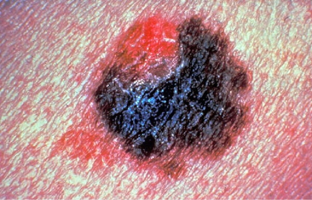 पाकिस्तान में खूब सुर्खियां बटोर रहीं आम की 3 नई किस्म