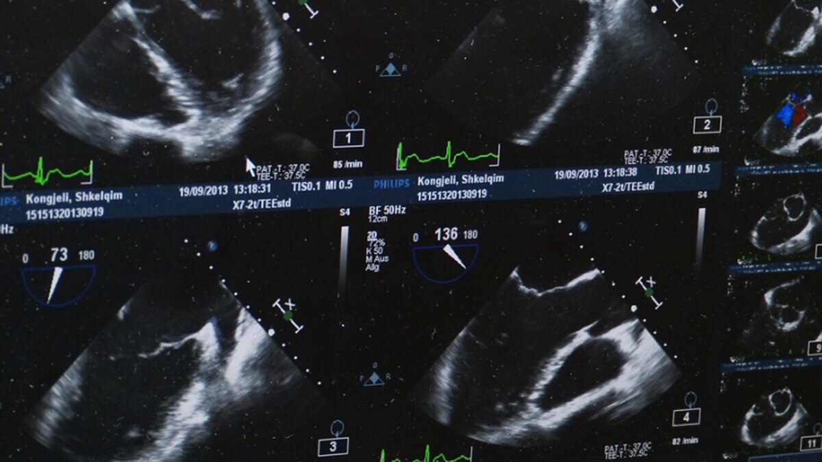 एग्स डोनेट करना आसान काम नहीं
