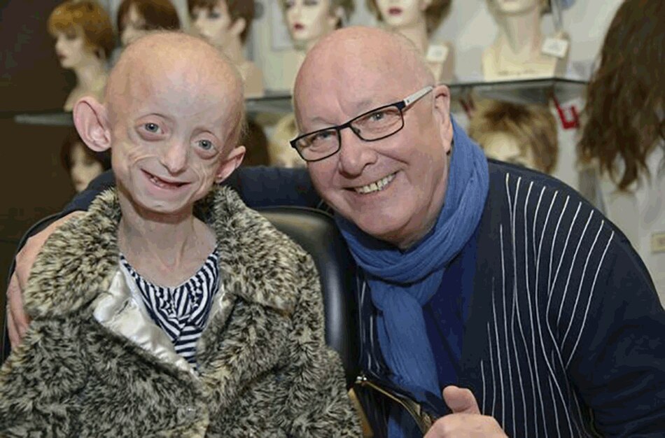 rare disease progeria