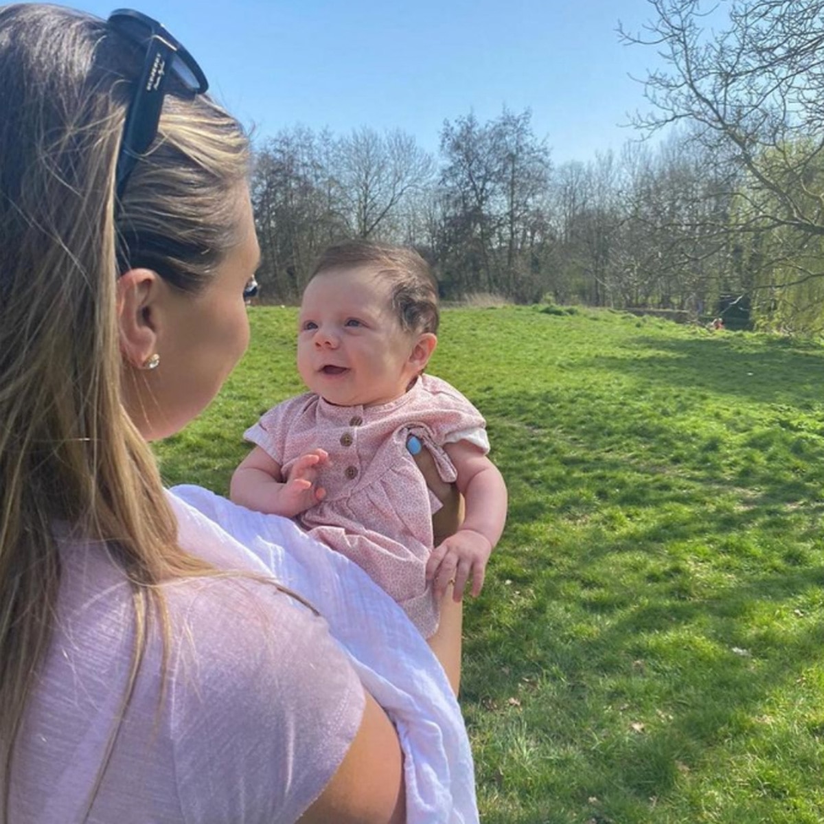 baby girl turning to stone