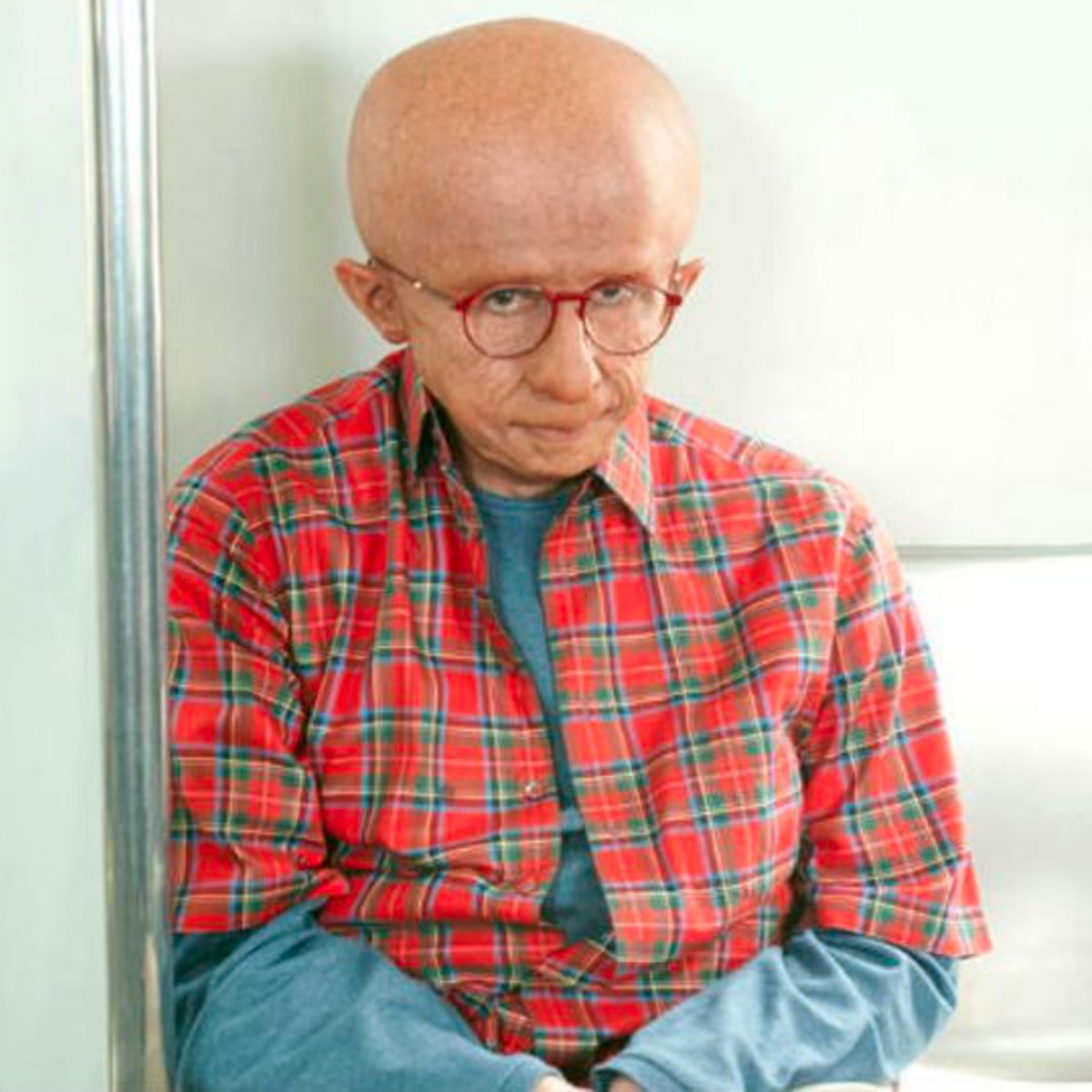 progeria disease