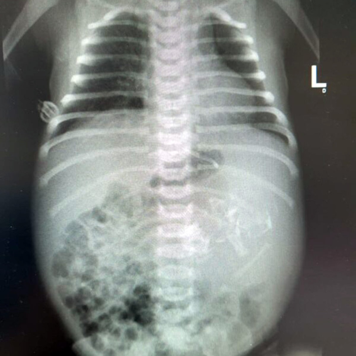 Twin Growing newborn 