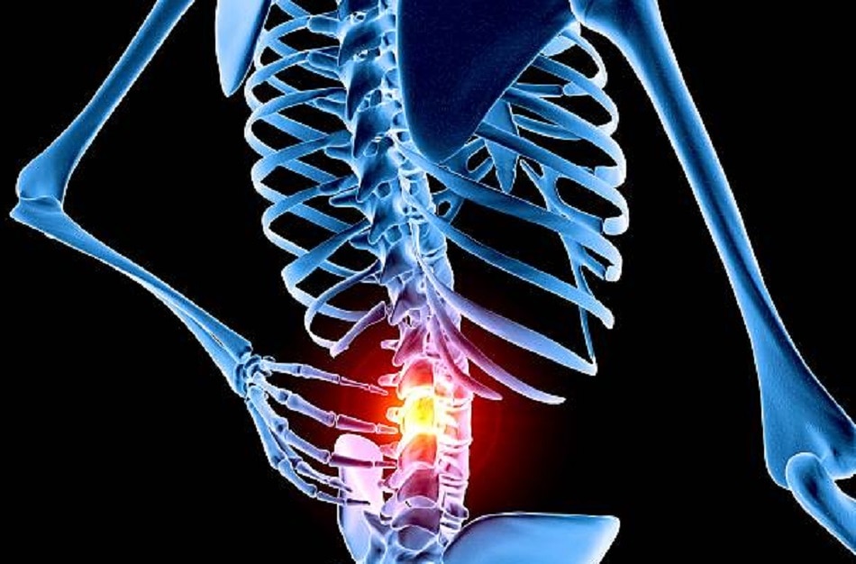 एवैस्क्लुर नेक्रोसिस