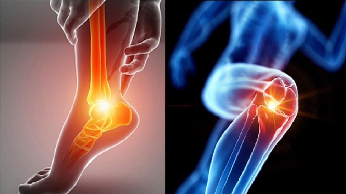 रनिंग से हो सकते हैं घुटने खराब? दौड़ते वक्त कभी न करें ये 5 गलतियां