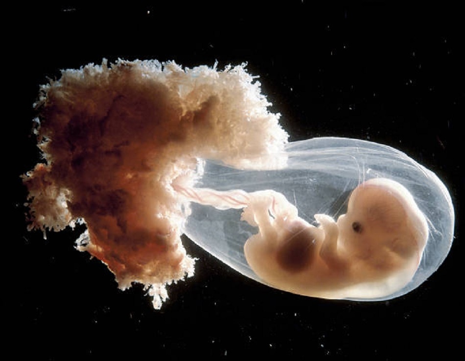 क्यों और कैसे पैदा होते हैं जुड़वां बच्चे?