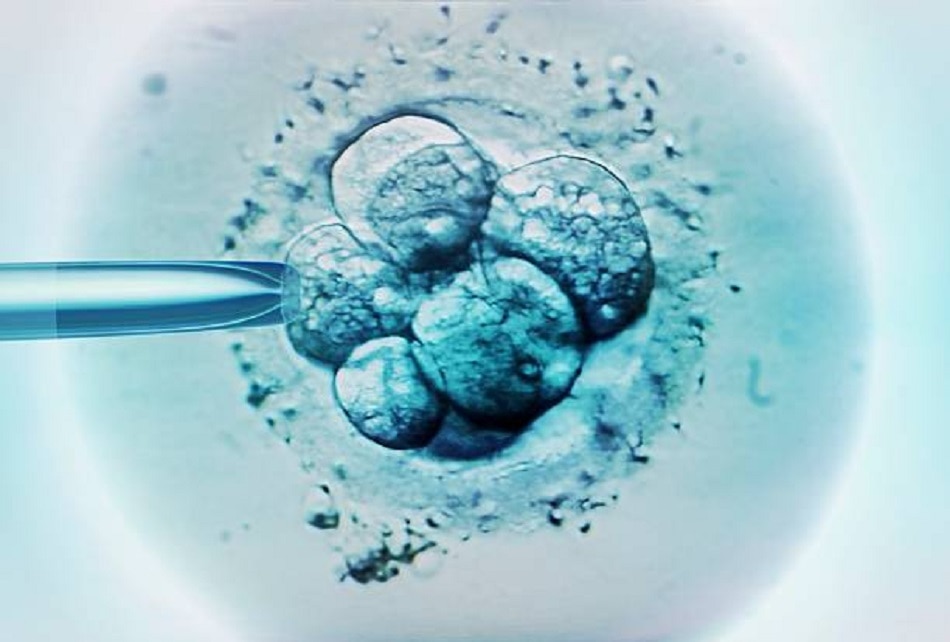 क्यों और कैसे पैदा होते हैं जुड़वां बच्चे?