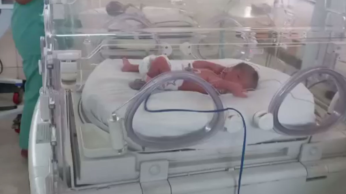 एक साथ 4 बच्चों को जन्म