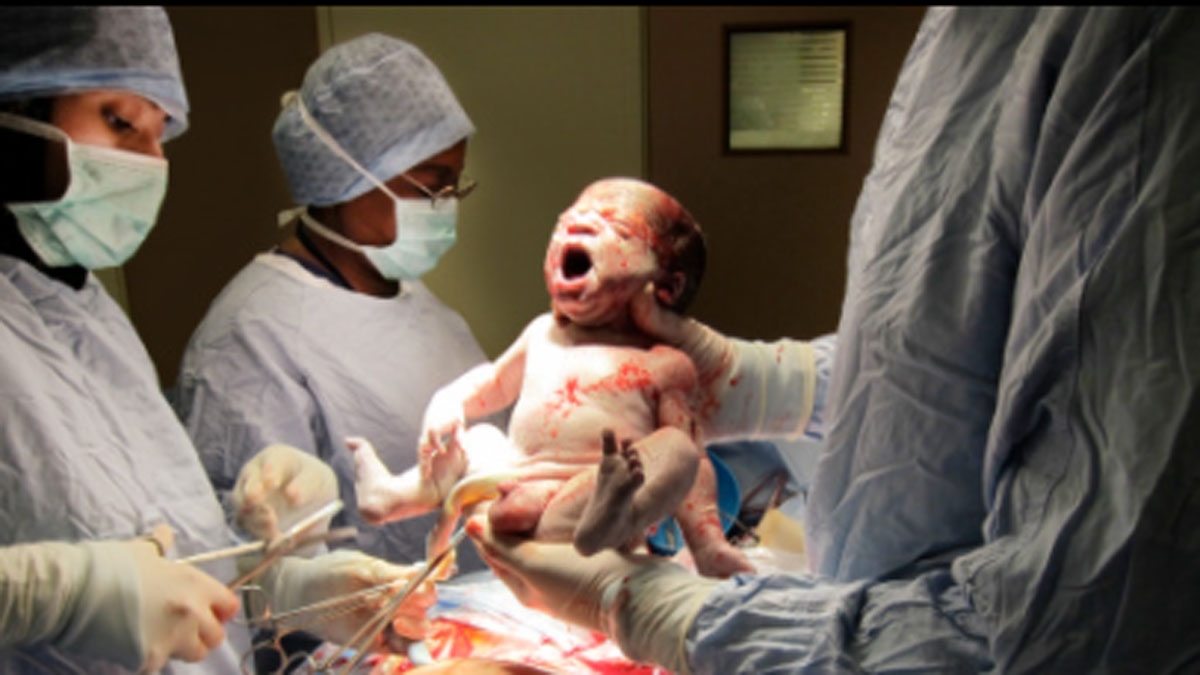 एक साथ 4 बच्चों को जन्म