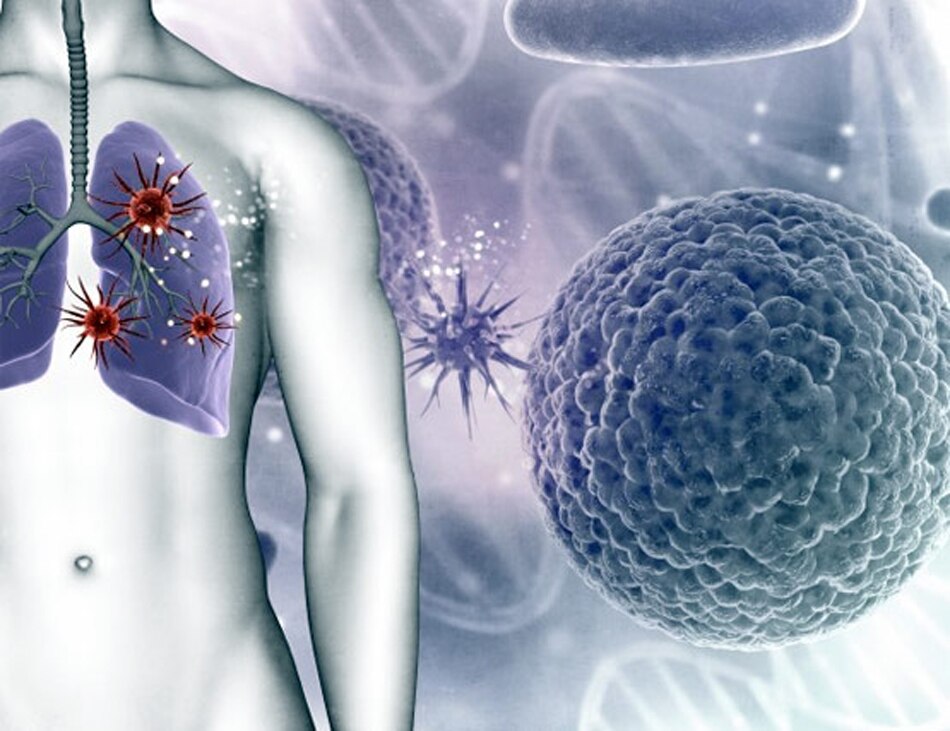 बेल्जियम का मामला