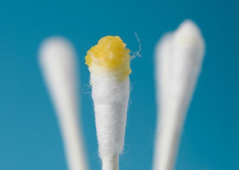 कान का मैल से पहचानें घातक बीमारी