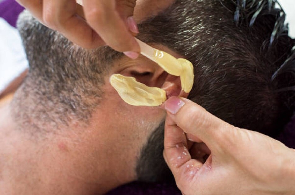 कान का मैल से पहचानें घातक बीमारी