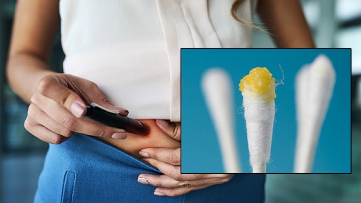 कान का मैल से पहचानें घातक बीमारी