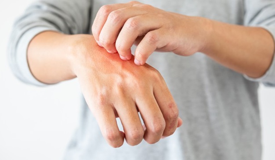 दाद, खाज और खुजली