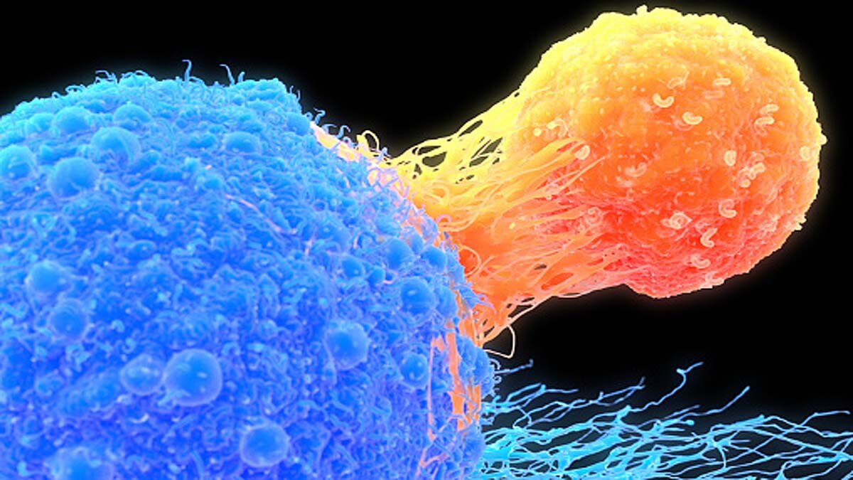 Long Covid Firbomyalgia