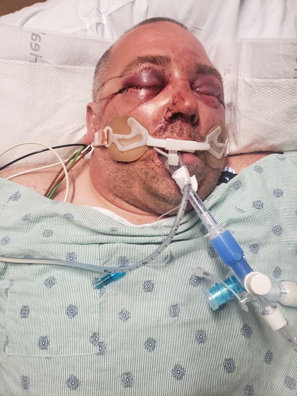 man beaten for stopping music