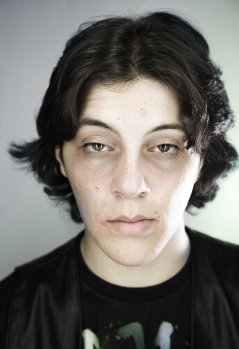 पीला चेहरा और आंखें-