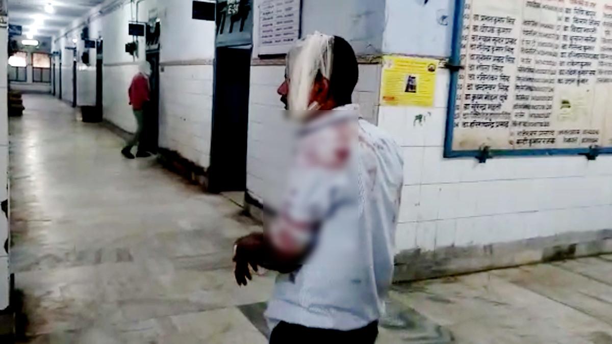 लॉकडाउन में कमाई हुई बंद, पत्नी और साले ने कर दी पिटाई, पति का फटा सिर