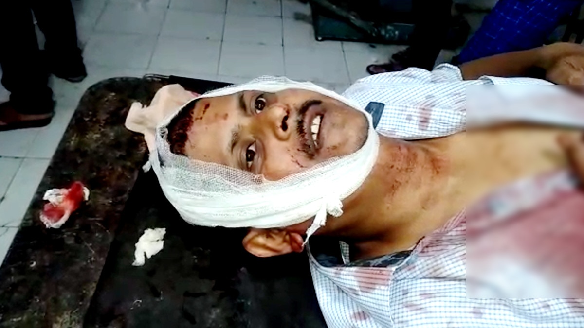 lockdown Man beaten up by wife and brother in law