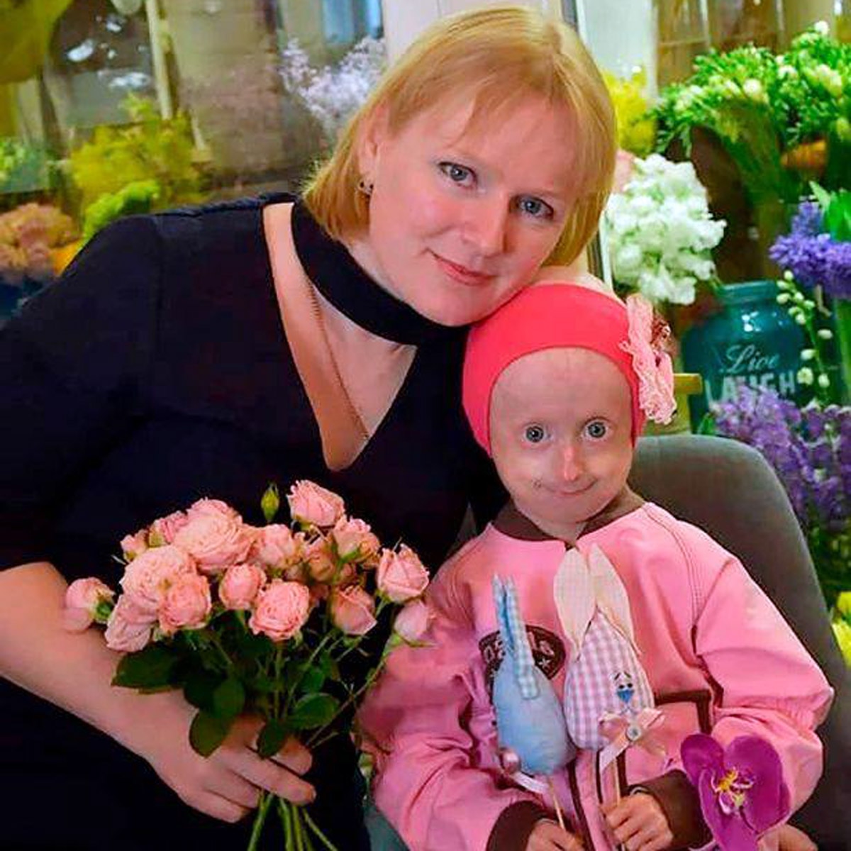 progeria disease