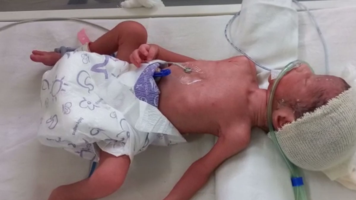 एक साथ 4 बच्चों को जन्म