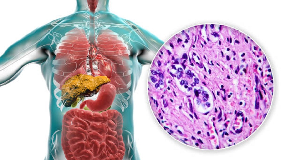 छाती के बाद लिवर पे कोरोना का अटैक