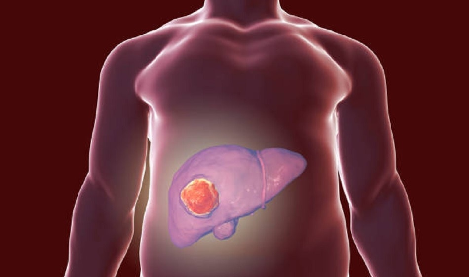 लिवर डैमेज कर रहा इम्यूनिटी बढ़ाने वाला गिलोय