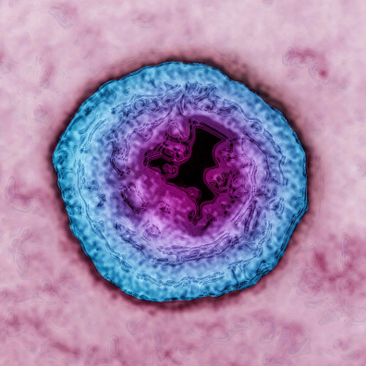 Monkey B virus