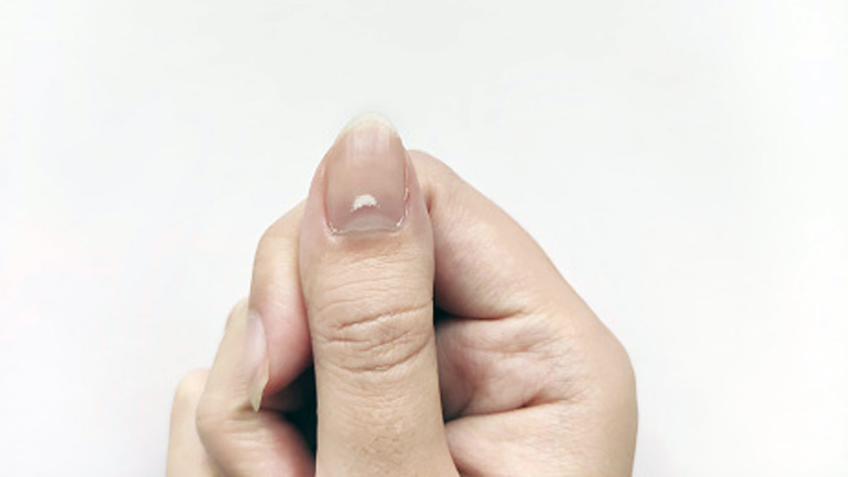 सफेद नाखून