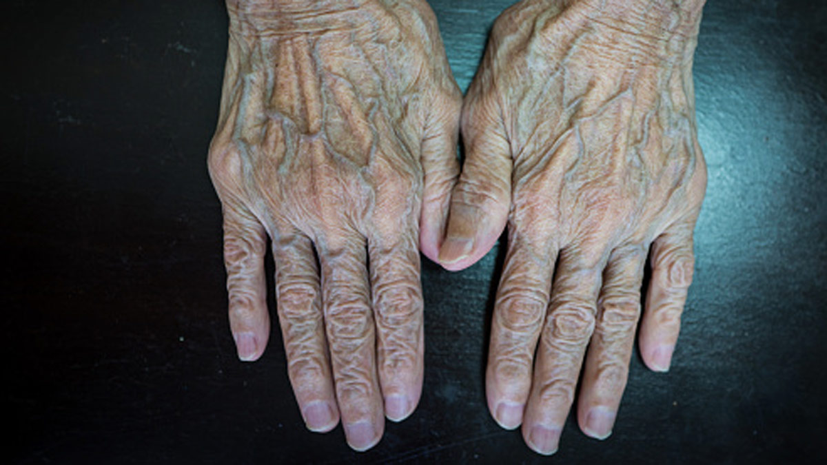 नीले नाखून