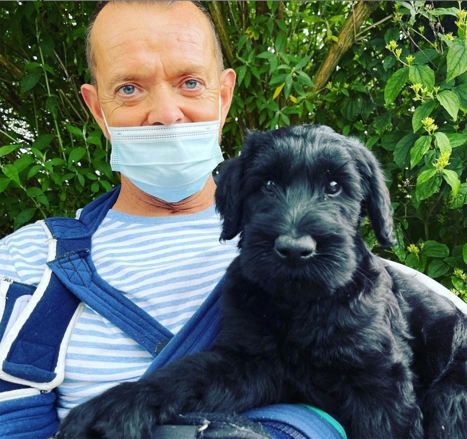 First double hand surgery