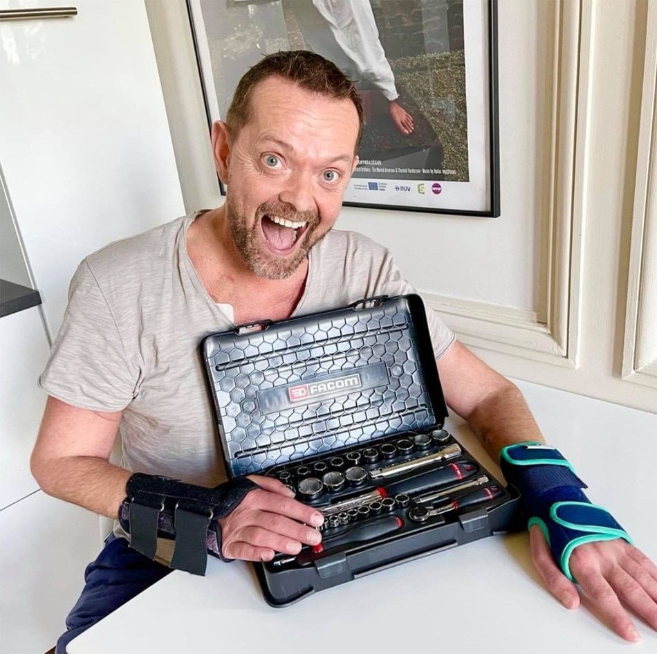 First double hand surgery