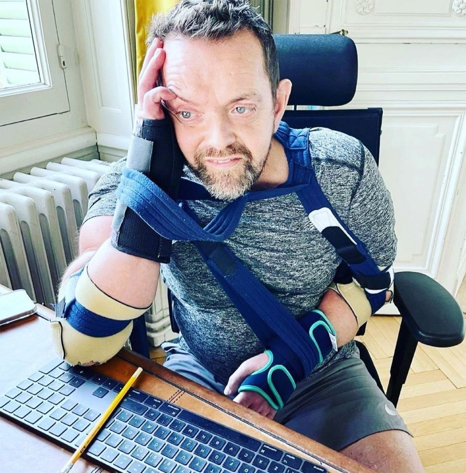 First double hand surgery