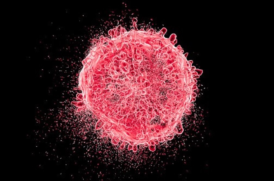 बच्चे में अजीबोगरीब लक्षण देख चिंता में डॉक्टर