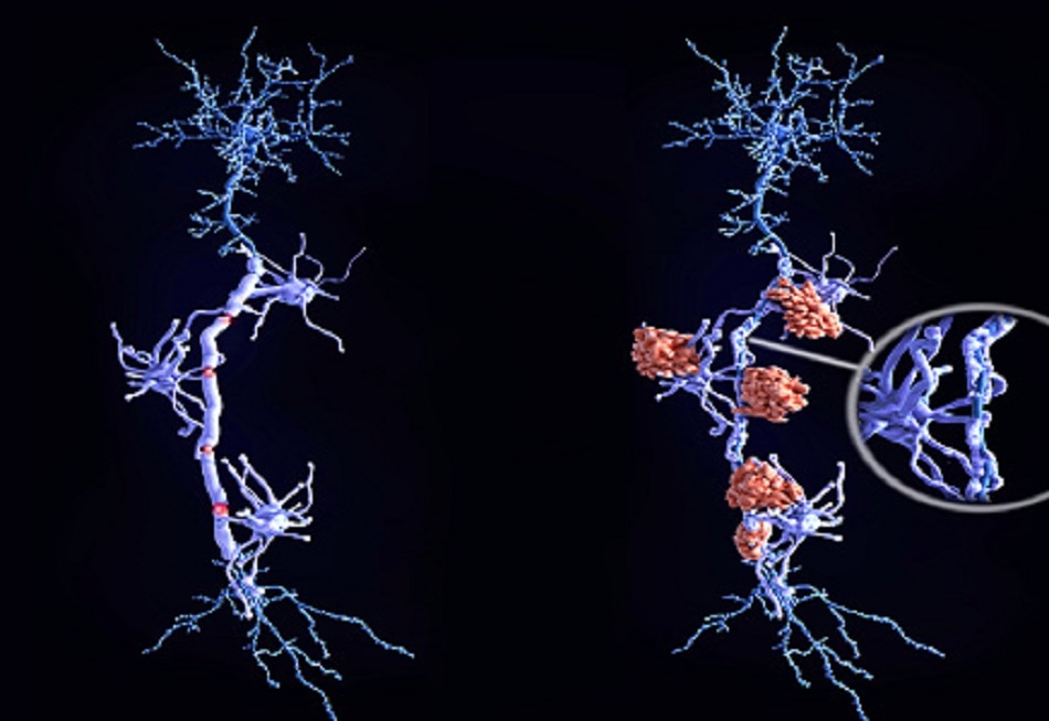 बच्चे में अजीबोगरीब लक्षण देख चिंता में डॉक्टर