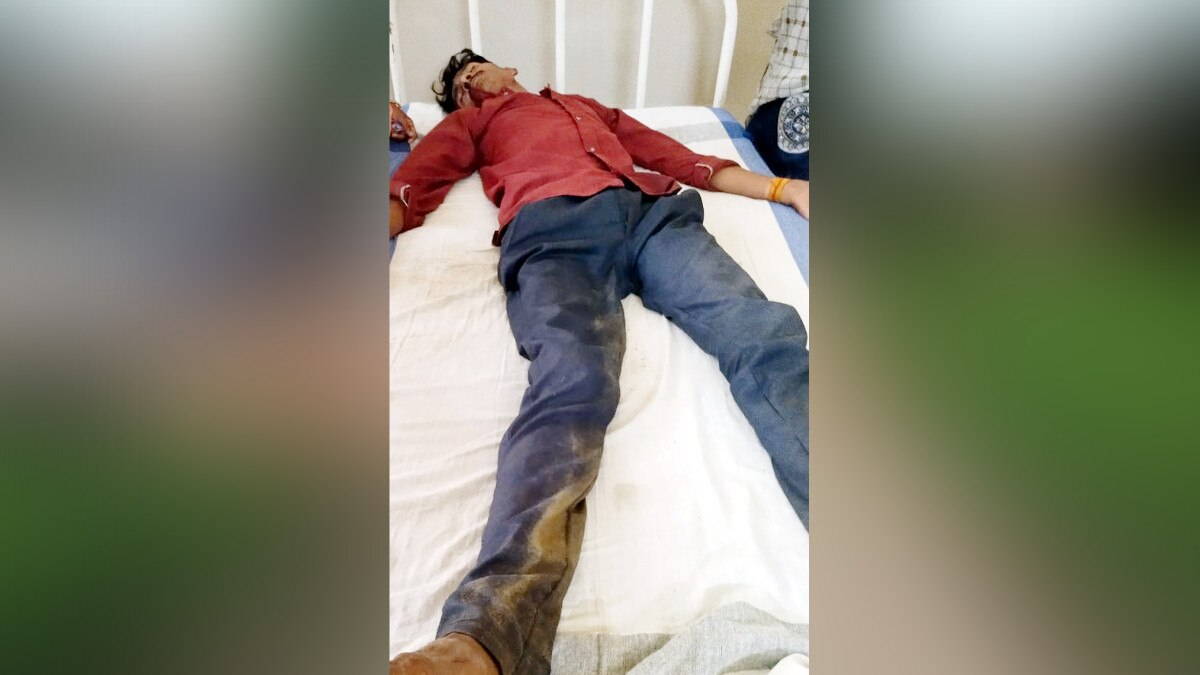  Drunk accused ate policeman ear said ate raw meat at the behest of the ghost 