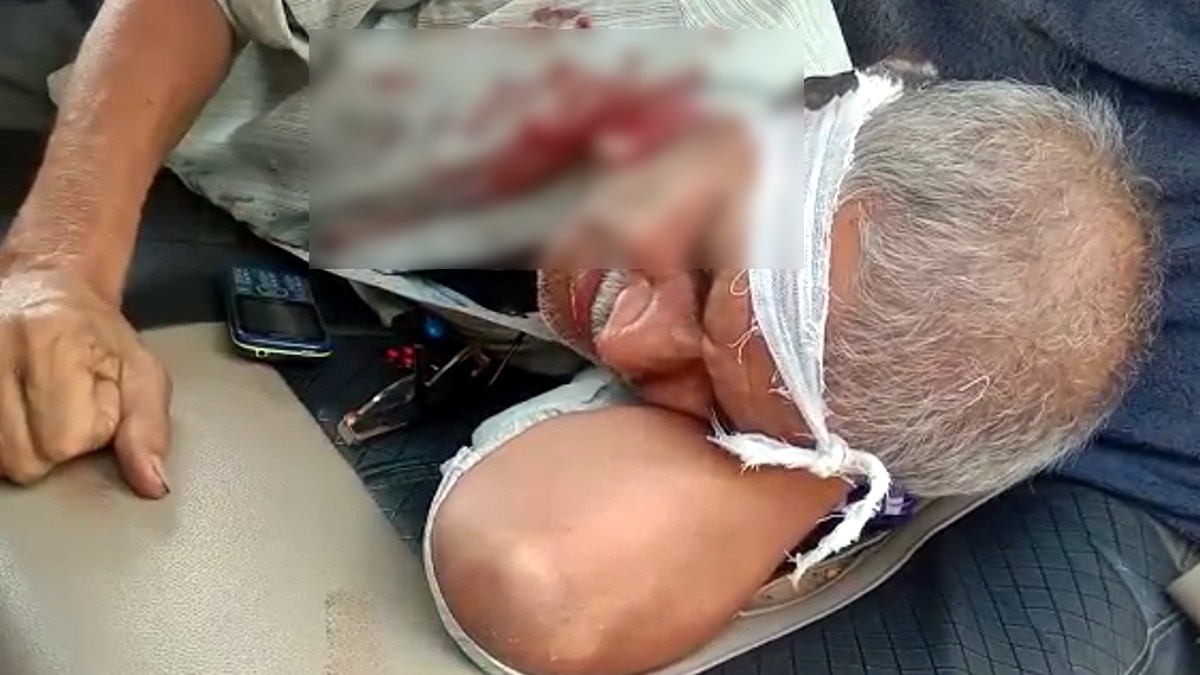  Drunk accused ate policeman ear said ate raw meat at the behest of the ghost 