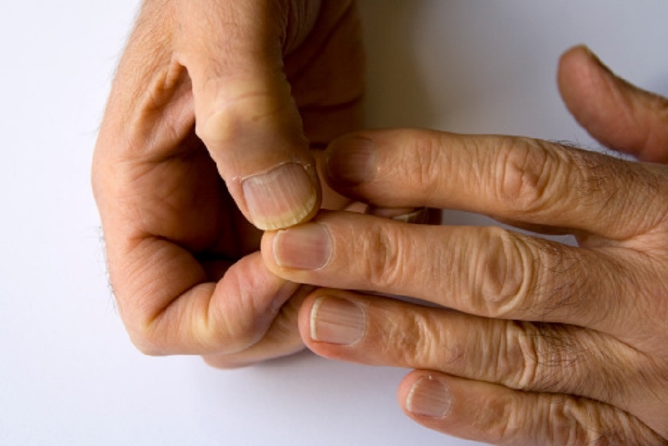 लक्षणों से पहचानें शरीर में प्रोटीन की कमी