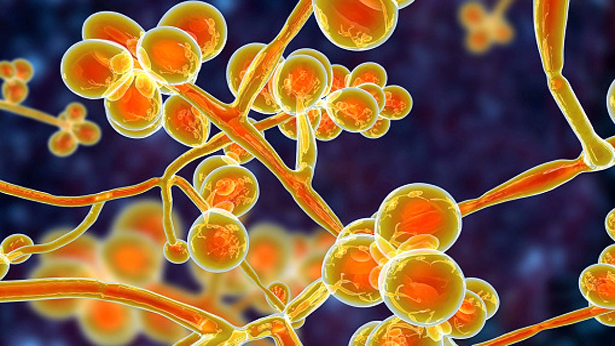 Superbug Fungus in US