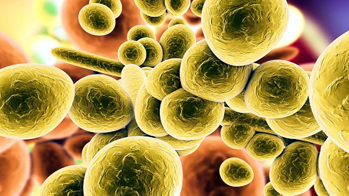 Superbug Fungus in US