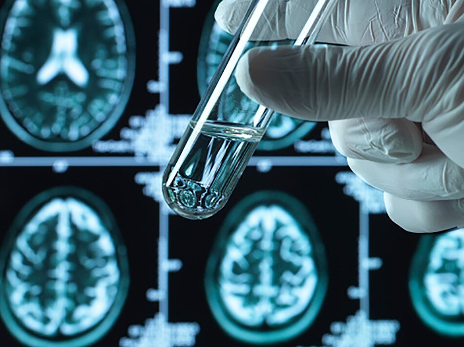 प्रतीकात्मक फोटो (Getty)