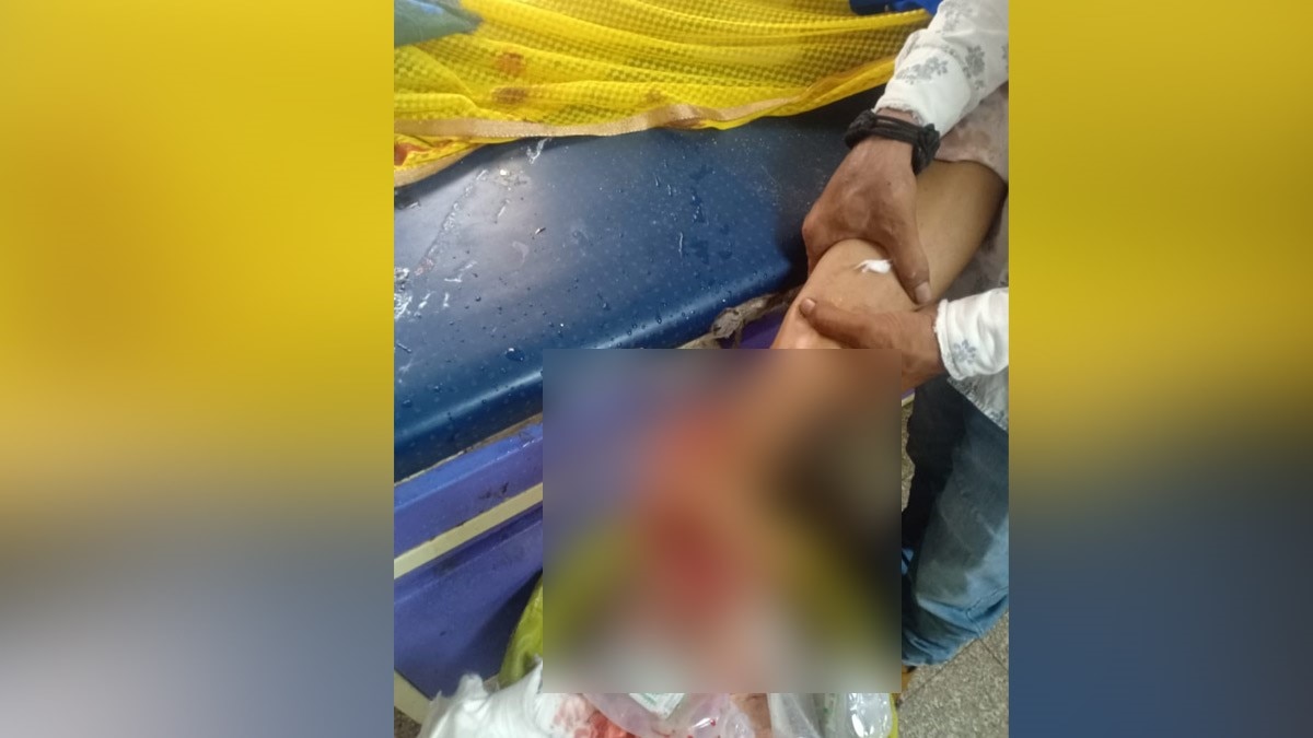 लड़की के साथ बर्बरता काट दी पैर की उंगलियां और एड़ी