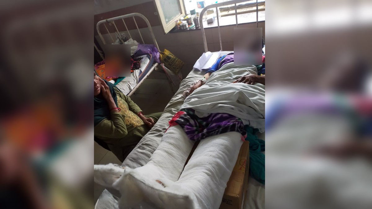 लड़की के साथ बर्बरता काट दी पैर की उंगलियां और एड़ी 